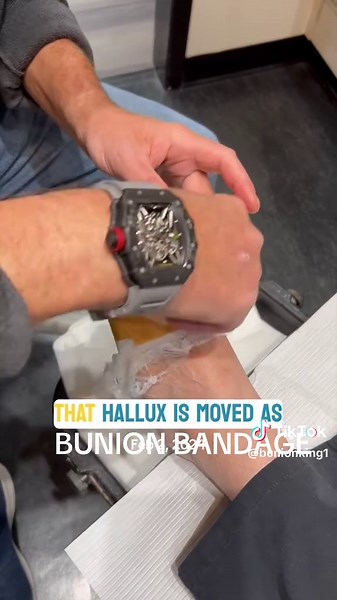 Bunion Surgery Recovery Tips and Techniques