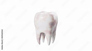 Human tooth model, tooth with plaque, unhealthy tooth, alpha channel, 3d rendering.