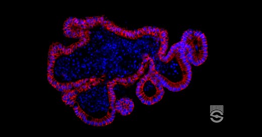 Establishing Organoid Culture from Mouse Intestinal Crypts