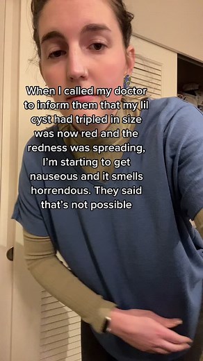 Well I hate to break it to you…. #cyst #infection #fyp #ineedabreak #doctorssuck