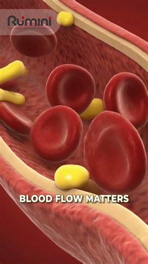 Smoking & Erectile Dysfunction: The Hidden Connection Men Need to Know 🚬⚠️