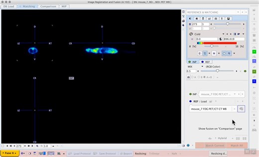 医学图像处理和分析软件 PMod（S2E2 ）： Image matching and fused rotating MIP for presentation