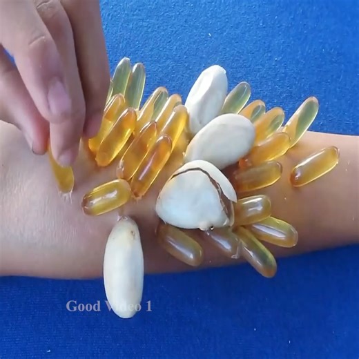 Removing and Picking a Ticks 2485 | Good video 1