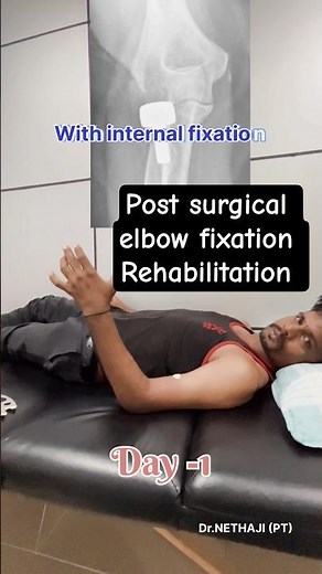 Post surgical elbow rehabilitation: Arogya physiotips #elbowinjury