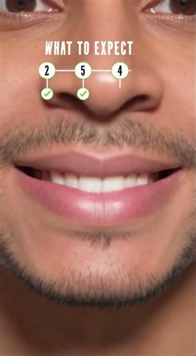 🦷 Tooth Extraction: What’s Normal on Day 5?