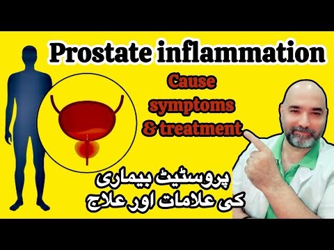 Prostate | inflammation & treatment || پروسٹیٹ بیماری کی علامات اور علاج #spanishpk