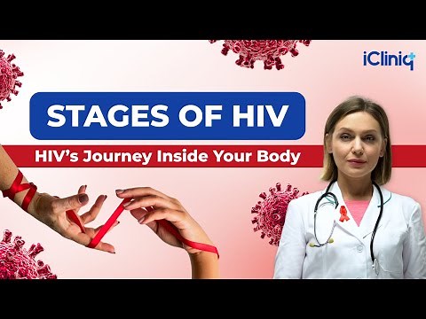 Stages of HIV: What You Need to Know | iCliniq #hiv #hivsymptoms #hivstages #aids
