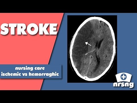 Stroke Nursing Care