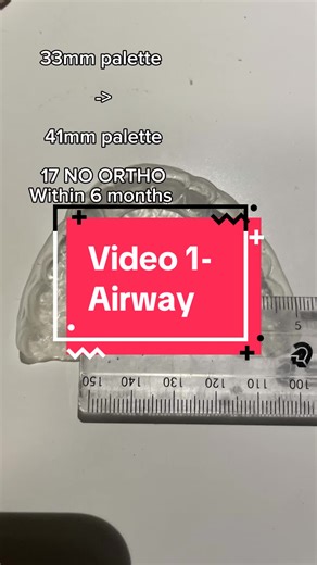 Larping high IQ, let me cook 🔥#airway #airwayhealth #orthodontist #dentist #fyp