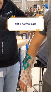 This doesn’t look like a cast… but it is 😳 | Startup Selfie
