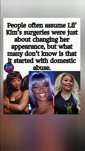 Lil’ Kim’s Surgery Secret: The Shocking Truth Behind Her Transformation 😱💔 #shorts