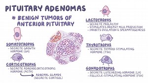 Video: Pituitary adenomas and pituitary hyperfunction: Clinical - Video Explanation! | Osmosis | Osmosis