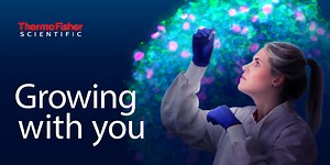 Disease model generation: 5 steps to a 3D cancer spheroid model