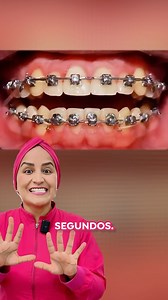 Dos años de brackets resumidos en un Timelapse de 10 segundos 👀 . No esperes más para lograr la sonrisa que siempre soñaste ✨ #sonrisa #ortodoncia #dental #brackets | Atracción Dental - Dentista Especialista en Ortodoncia