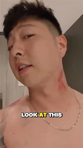 Traditional Coin Scraping Massage in Indonesia 🇮🇩