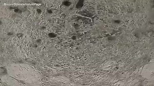 33K views · 969 reactions | Medicine is going so far !!! Amazing and proud to be a doctor :) Follow us on instagram : the_surgery_medicine | The Surgery | Facebook