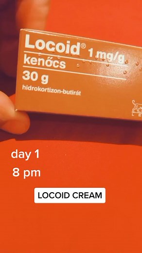locoid 1mg/g lets see if my hand and finger healed using this product
