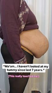 Many mothers feel upset seeing their tummy even years after delivery. But tummy bulge after delivery is not always because of fat or weight gain. Often it happens due to weak core muscles, scar tightness, and poor pressure control inside the abdomen. recovery is possible even years after delivery with the right rehab and exercises. We have already shared many videos explaining solutions and safe exercises to help mothers recover. Don’t lose hope. Your body just needs the right guidance and care.