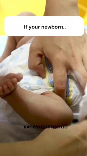 Understanding Your Newborn’s Stool Patterns: A Quick Guide When your newborn arrives, expect their first bowel movement to be meconium—a dark green and tarry stool—within the first 24 hours of birth. 🍼 By the 3rd day, you might notice an increase in stool frequency, with the stools becoming semi-loose and greenish-yellow. These will typically normalize within the next 1-2 days. So don't panic. By the 5th to 7th day, breastfed babies often produce frequent golden-yellow, semi-loose, and sticky s