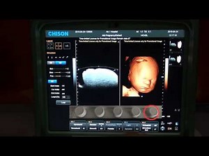 CHISON 4D Training Video