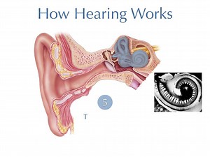 Learn how hearing works with microtia and atresia: | Dr. Sheryl Lewin, Microtia Ear Surgery