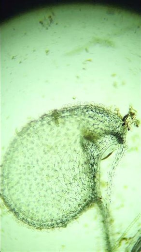 Tiny Worm Trapped Under Microscope 🔬 Aquatic Carnivorous Plant Trap 🌱 #Utricularia