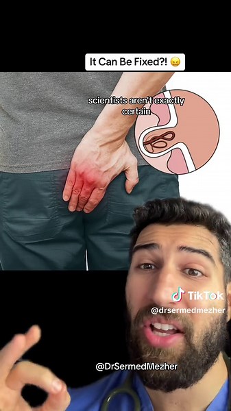 Living with a Pilonidal Sinus: Challenges and Discomforts