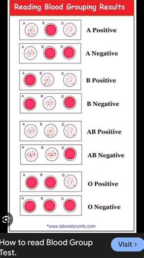 how to read a blood test / how to read blood test report / blood test report chart / #shorts