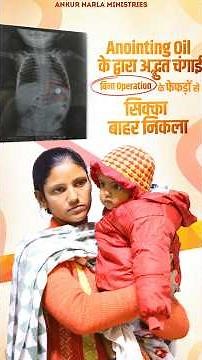 बिना Operation के फेफड़ों से सिक्का निकला बाहर #testimony #ankurnarulaministries #anugrahtv
