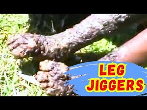 👉 Jiggers in Legs 😨 | Early Signs Most People Ignore