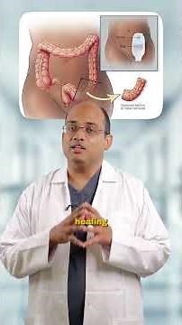 Risks of Anastomotic Strain – Why Healing Matters