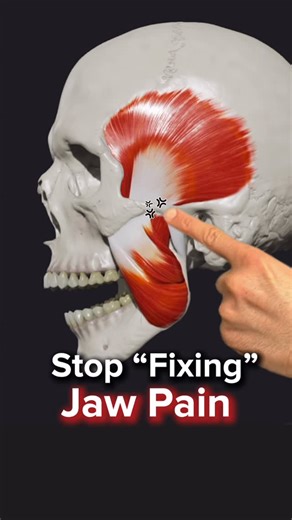 Dr. Joe Damiani - TMJ, Head & Neck Specialist on Instagram: "💬 Comment ‘QUIZ’ on this video, and I’ll send you a DM to take my Root Cause Quiz and finally figure out what’s causing your pain! Jaw Pain for 3 months or longer? And it just won’t go away? When it comes to pain in the Jaw and Face region, there are three major causes: 👉🏼 Referred from Neck: > YES, pain from the neck can actually refer to the jaw, in the absence of any jaw injury at all! 👉🏼 TMJ (Jaw Joint) > The actual jaw joint 