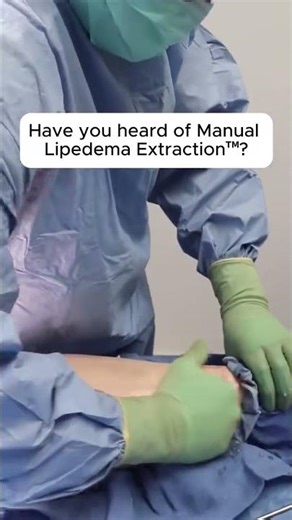 What are the benefits of MLE™ (Manual Lipedema Extraction™)? We get this question a lot, so here’s a