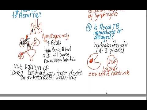 Renal Tuberculosis of Kidney and Urinary tract