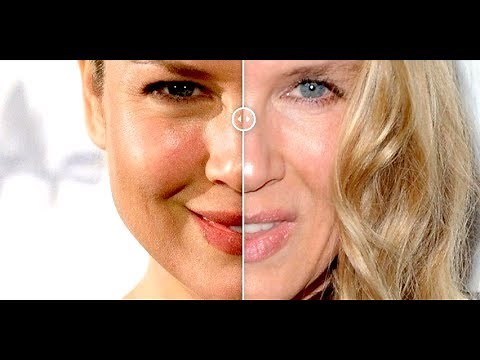 Renee Zellweger Before And After | Then And Now | Changing Face