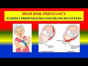 HIGH RISK PREGNANCY - definition , incidence, complications and management