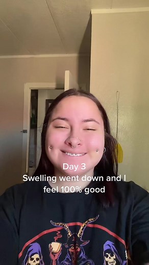 Exploring Dimple Piercings: Pain, Reviews, and Ratings