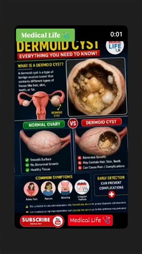 😱 What Is This Lump on Your Wrist? | Ganglion Cyst Explained!