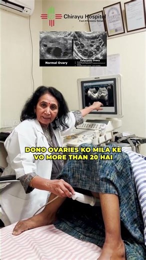 Treating PCOS Step-by-Step Before Fertility Procedures