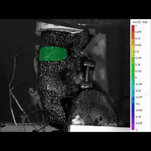 The Spinal Biomechanics Lab at the Sonntag Spine Center helps neurosurgeons analyze different patient surgical options. Here is an example of a cadaver spine being robotically tested for flexibility and stress distribution to ensure the best treatment options are used. Your support allows experts at Barrow Neurological Institute to discover new methods for spine surgery, reducing back pain, and repeat surgeries. Donate today: giveto.supportbarrow.org/spine | Barrow Neurological Foundation