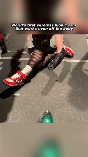 World’s first wireless bionic arm