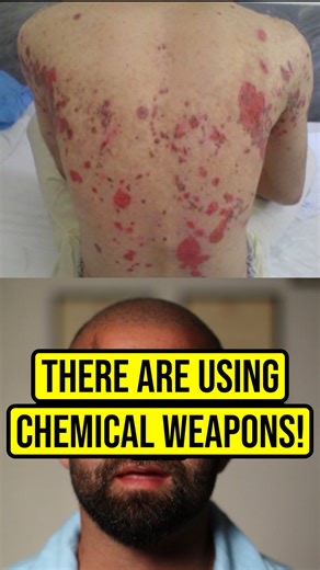 Dr. Keyan Zomorodi, MBBS, Bsc on Instagram: ". ⚠️ Under international law chemical warfare classifies as weapons of mass destruction 🆘 We urge any international aid to make their move and target this evil regime #iran #iranian #iranrevolution #makeirangreatagain #freeiran #iranprotests #persia #persian #rezapahlavi #pahlavi #chemicalwarfare #crimesagainsthumanity #humanrights"