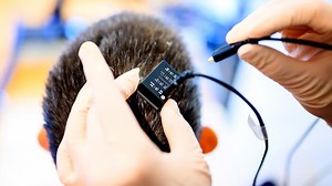 Brain implant helps woman with paralysis speak with her own voice again