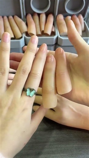 A prosthetic hand restarts life finger loss prosthetic finger