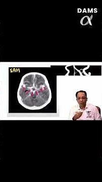 DAMS Brain Zap - Radiology