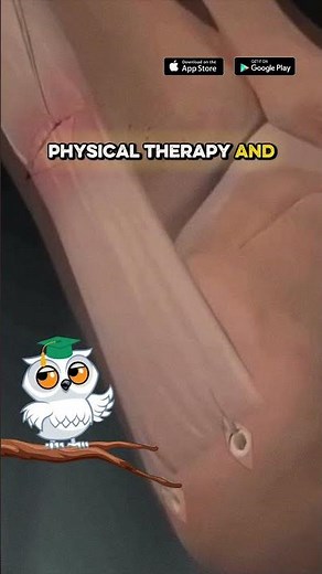 How Achilles tendon reconstruction is performed