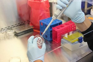 A New Source of Brain Cells for Research | Neuroscience