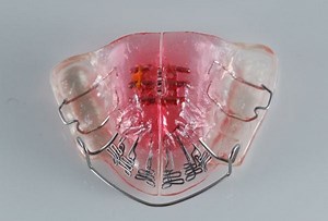 My thoughts on the DNA appliance