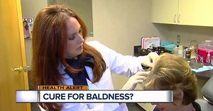 Dr. Nandi: How close are we to curing baldness?