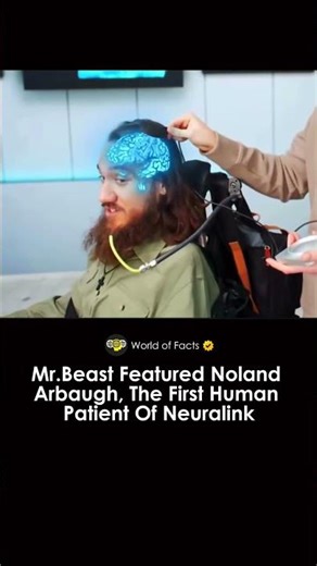 The First Human Patient of Neuralink ft. in Mr.Beast